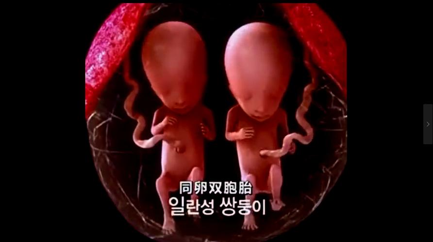 代生孩子双胞胎(一对双胞胎：代生孩子的奇迹)