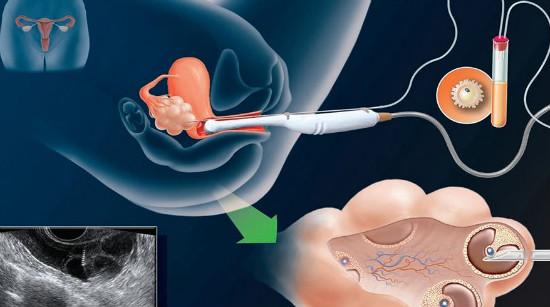 代生男孩包成功_代生男孩包成功:一场奇迹的诞生